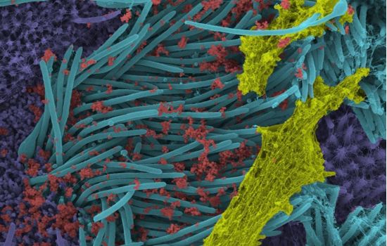 Imagens impressionantes mostram infecção por coronavírus nas células das vias respiratórias