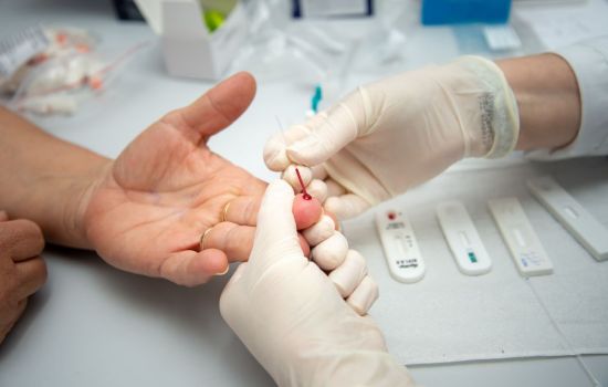Anvisa orienta farmácias sobre cuidados na aplicação de testes