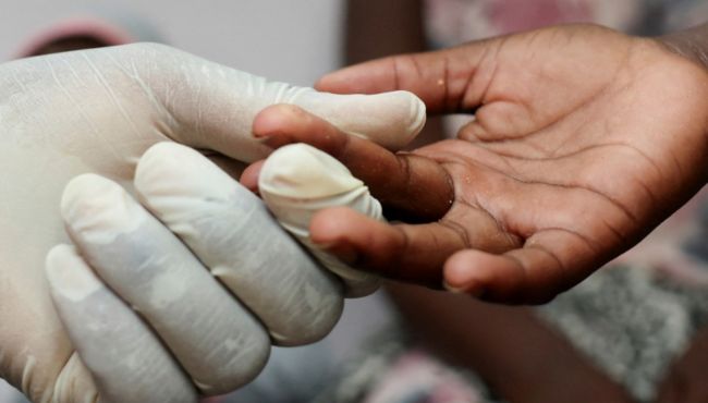 Brasil elimina transmissão vertical do HIV, da mãe para o bebê, e alcança menor taxa de mortalidade dos últimos anos