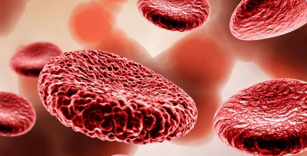 Descoberta iniciada nos anos 80 leva a tratamento inovador para anemia falciforme