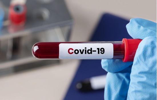 Inédito: mulher fica 152 dias com Covid-19 sem apresentar sintomas no Brasil