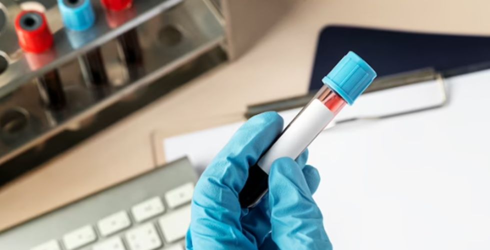 Nova era na Farmácia Clínica: Anvisa libera a realização de exames laboratoriais em Farmácias e Drogarias