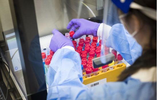 Antiviral demonstra alta eficácia contra a Covid-19