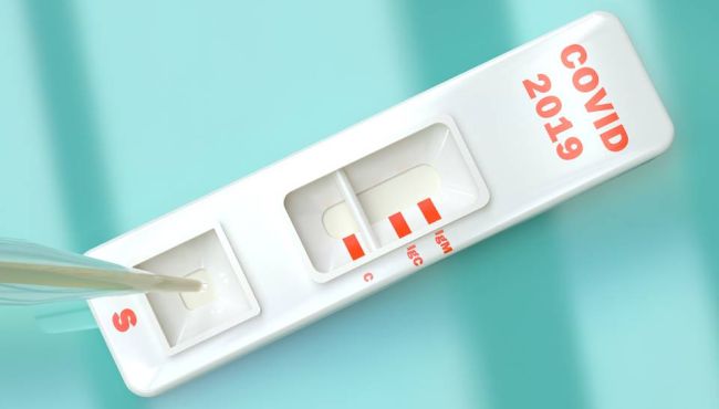 Covid-19: Anvisa deverá aprovar testes rápidos em farmácia em todo o País