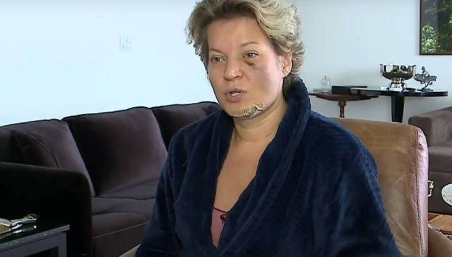 Caso Joice Hasselmann: reação adversa ao Stilnox  pode ter causado perda de memória