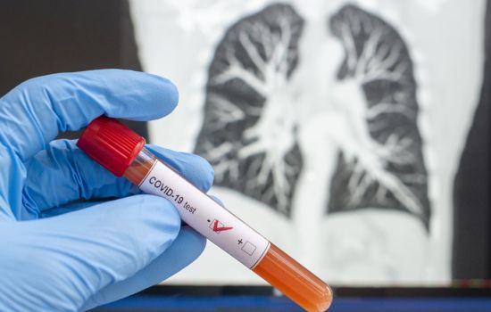 Saiba como as Análises Clínicas impactam o combate à pandemia