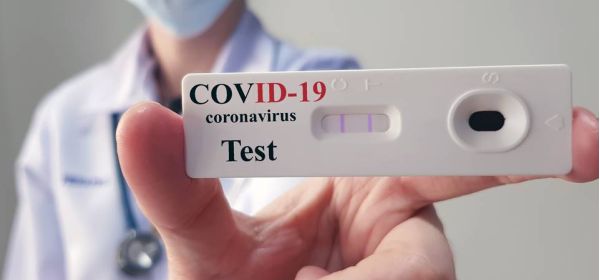 Covid-19: cresce realização de testes em farmácias, mas cientistas questionam eficácia