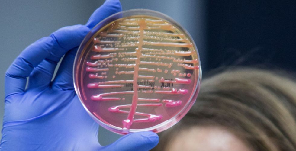 Pesquisadores da USP testam vírus como solução para infecções resistentes a antibióticos