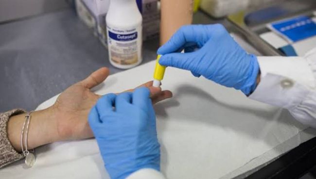 Covid-19: como preparar a farmácia para os testes rápidos