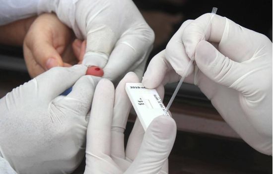 Covid-19: farmácia na UFRN realiza testes rápidos por R$ 250