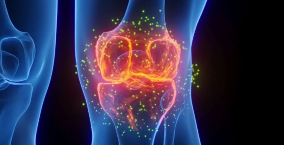 Terapia injetável experimental pode mudar a forma de tratar a osteoartrite