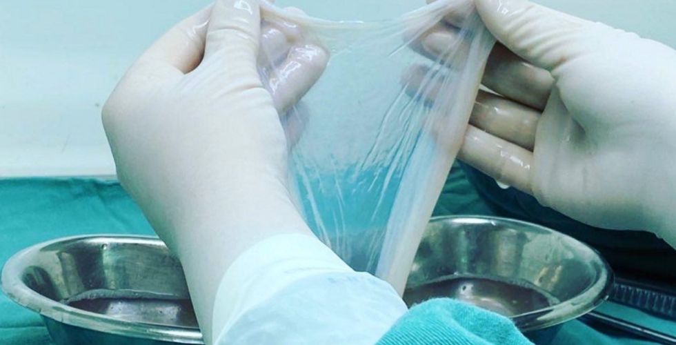 SUS incorpora membrana amniótica e amplia tratamento de feridas e doenças oculares