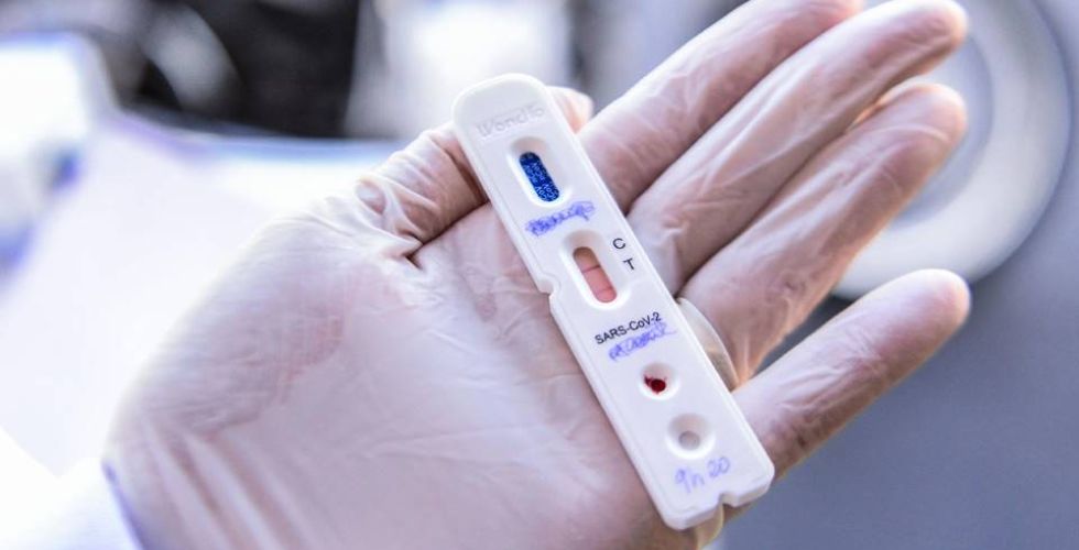 Justiça garante realização de teste rápido em farmácias