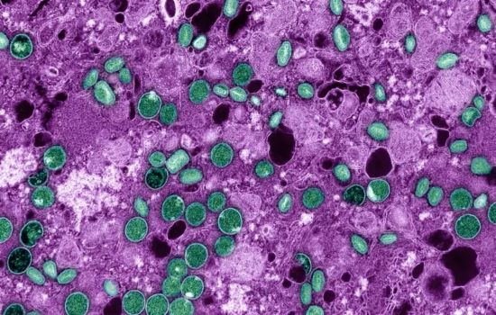 Nova cepa do vírus da mpox recombinante preocupa OMS e testes mostram que antiviral mais usado não é eficaz