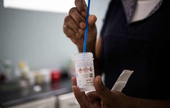 Exame de DNA para HPV detecta até seis vezes mais infecções que o Papanicolau