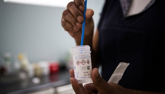 Exame de DNA para HPV detecta até seis vezes mais infecções que o Papanicolau