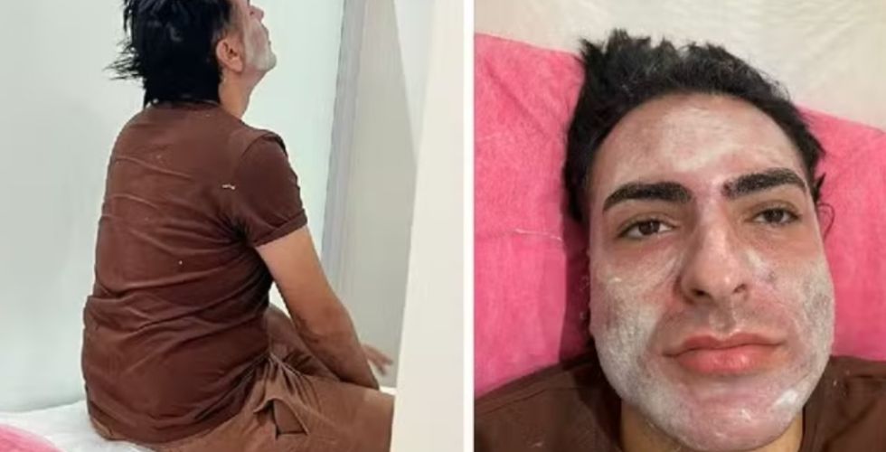 Curso de peeling de fenol é alvo de investigação após m0rt3 de empresário