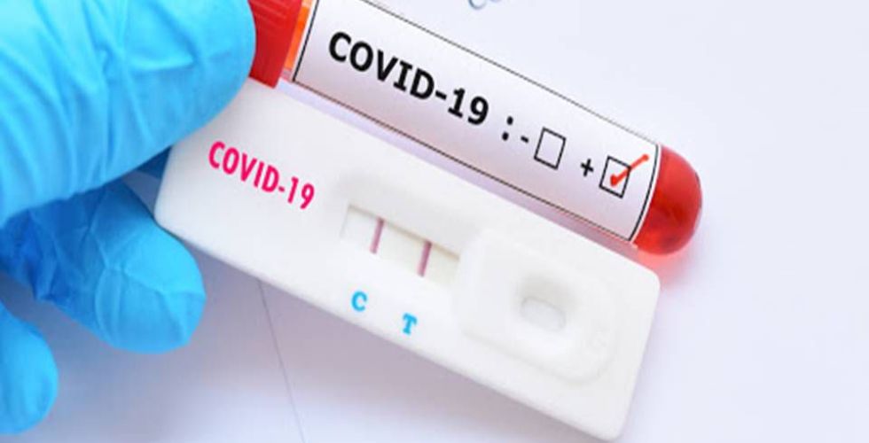 Farmácias devem informar sobre casos suspeitos de Covid-19 no Ceará