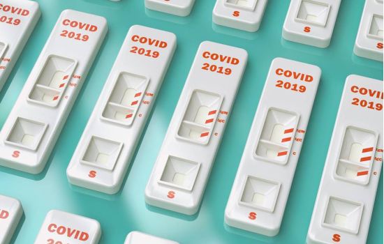 Covid-19: testes adquiridos pelo governo paulista aguardam registro da Anvisa para uso