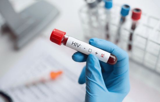 Cura do HIV pode estar em medicamento usado contra o câncer