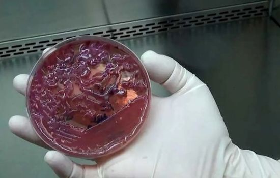 Superbactéria é identificada em 7 pacientes e leva ao fechamento de UTI