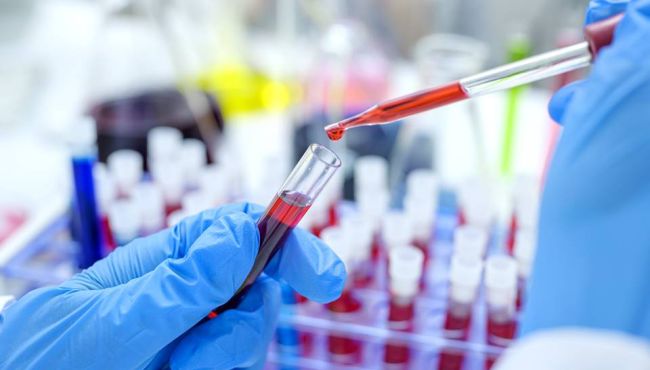 Rússia disponibiliza novo medicamento para tratamento da Covid-19