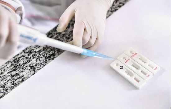 Fiocruz vai produzir 2,4 milhões de testes para diagnosticar coronavírus